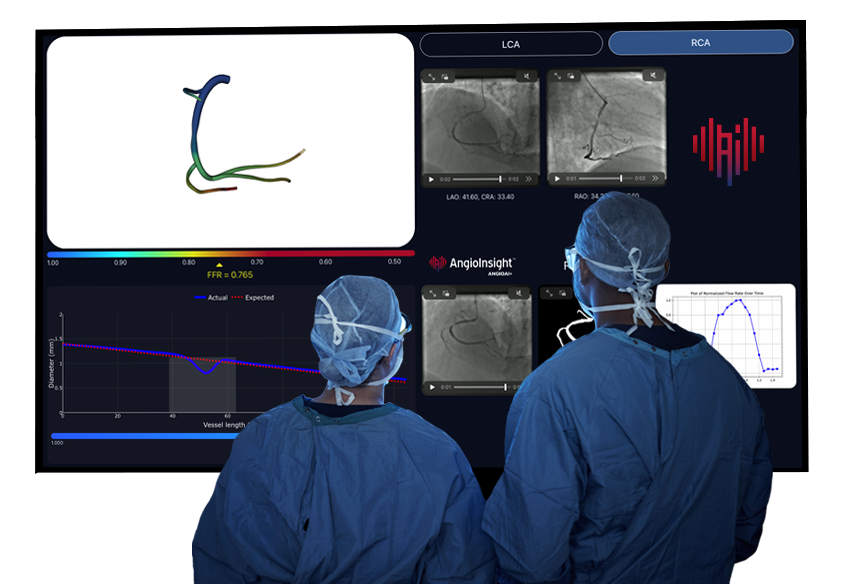 Surgeons reviewing AngioInsight software