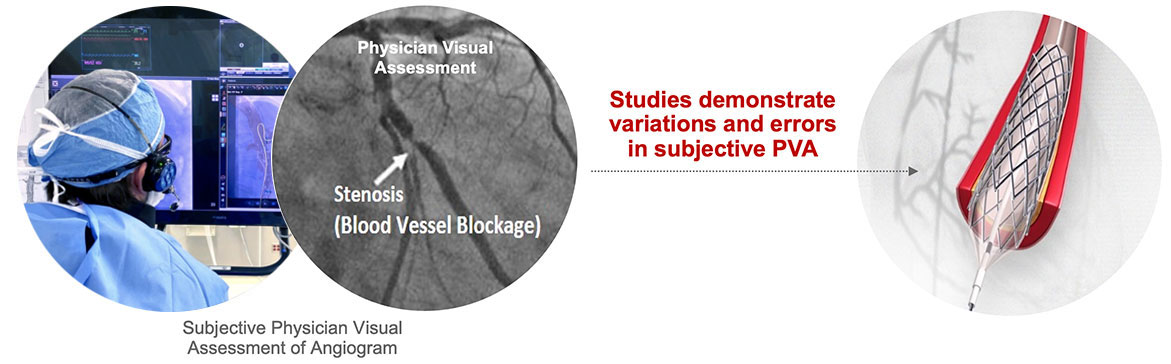 existing cath lab evaluation